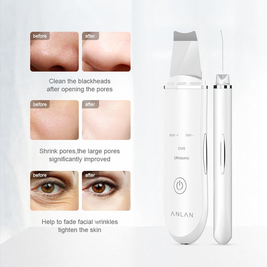 Ultrasonic Multifunction Smooth Skin scrubber Machine